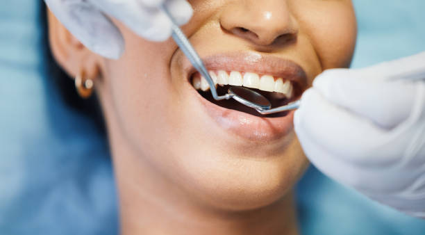 Dentist for Dental Trauma in NM